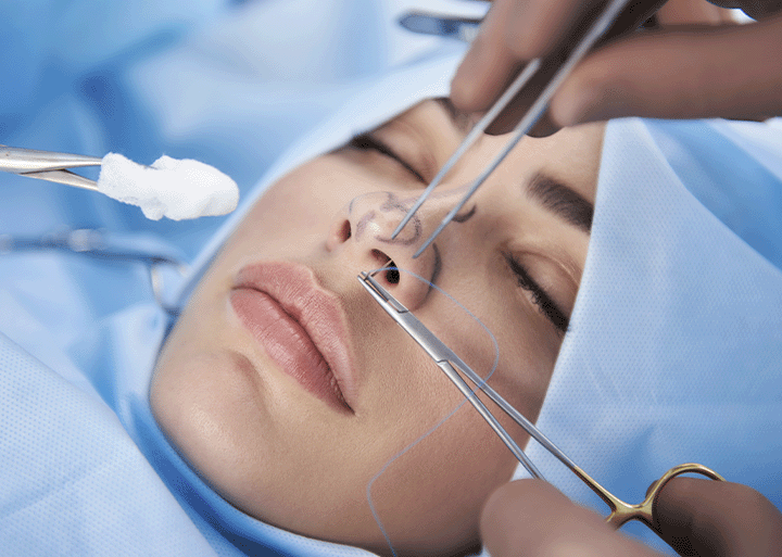 Can Rhinoplasty Reconstruct a Nose After Injury?