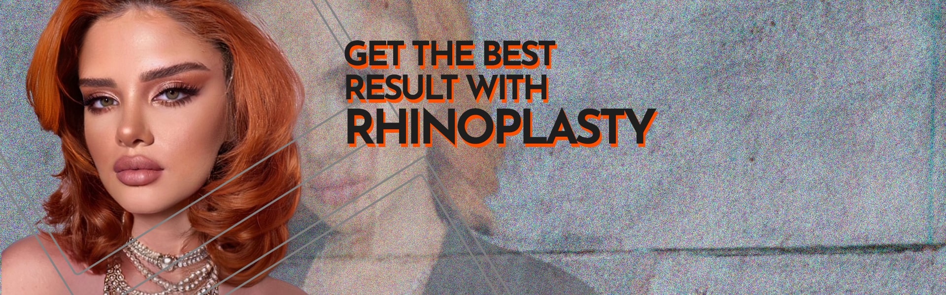 Get The Best Result with Rhinoplasty 