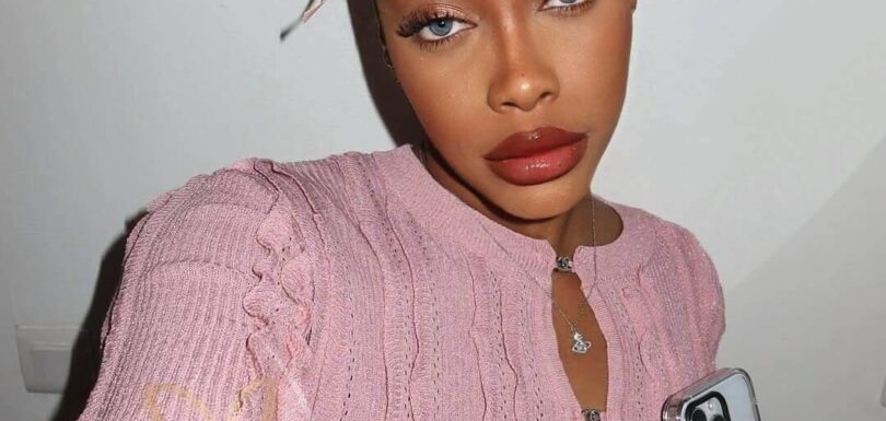 After ethnic rhinoplasty Turkey by Dr. Fatih Mehmet Hanege – natural nose reshaping preserving ethnic identity.