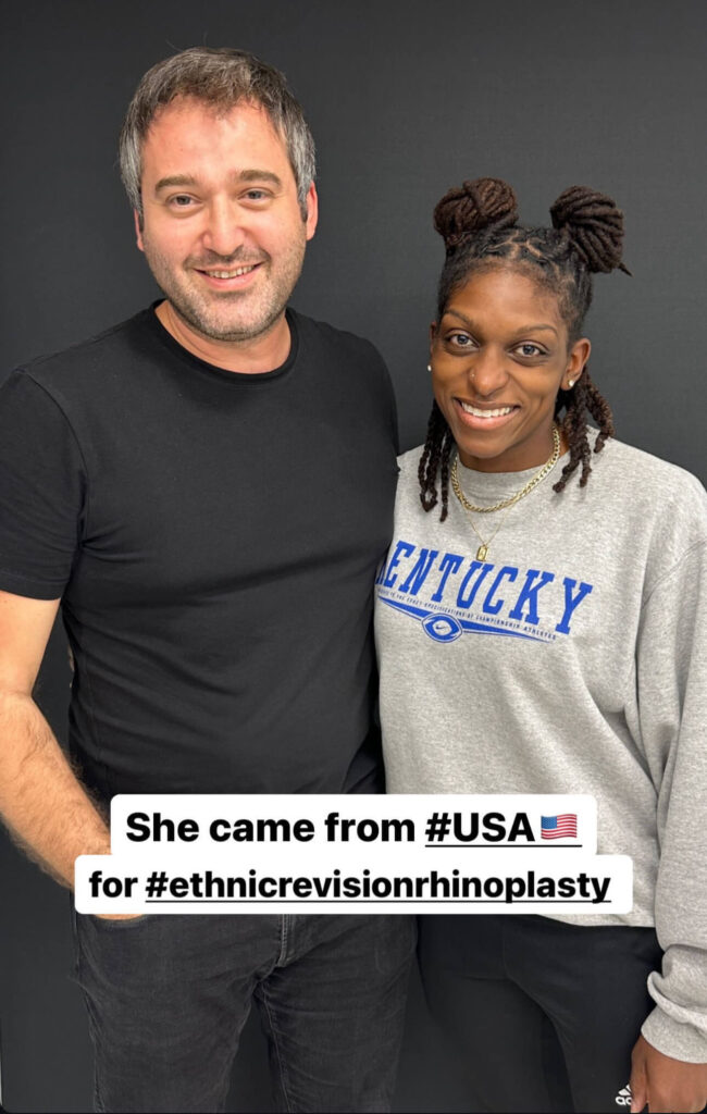 revision ethnic rhinoplasty patient visit from usa