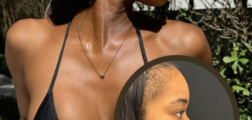 7 Key Facts About Ethnic Rhinoplasty in Istanbul